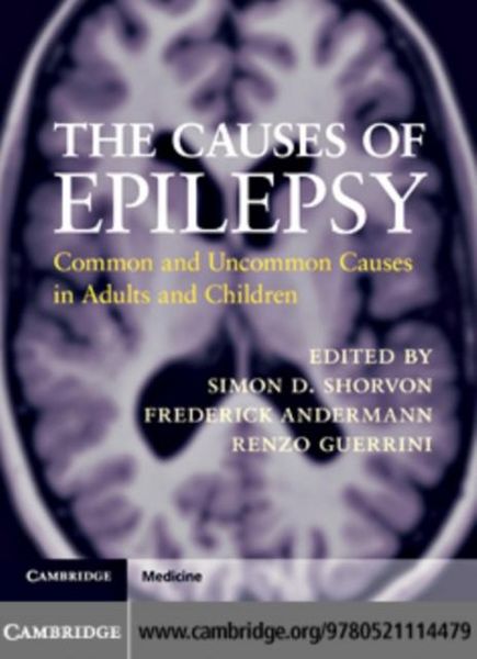 Produktbild: Causes of Epilepsy