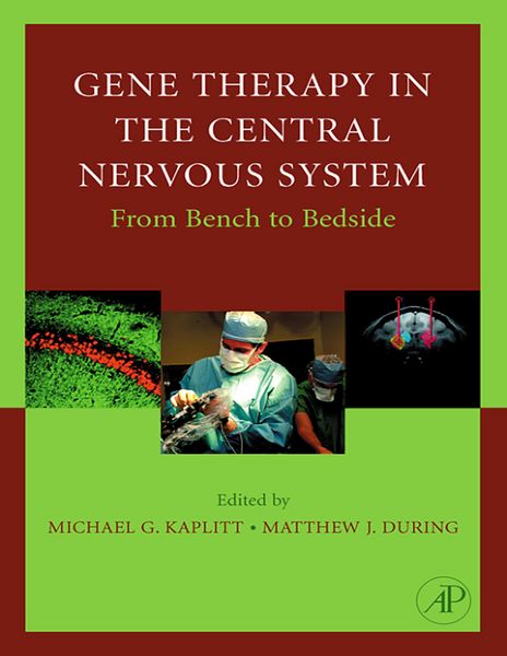 Produktbild: Gene Therapy of the Central Nervous System: From Bench to Bedside