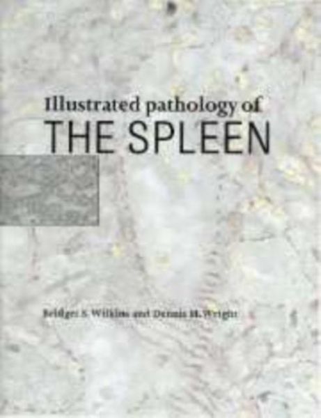 Produktbild: Illustrated Pathology of the Spleen