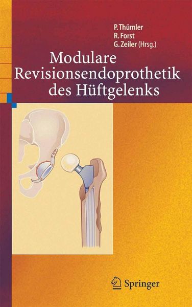 Produktbild: Modulare Revisionsendoprothetik des H&uuml;ftgelenks