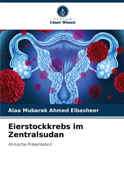 Eierstockkrebs im Zentralsudan, Taschenbuch von Alaa Mubarak Ahmed Elbasheer, Verlag Unser Wissen, 9786207745265