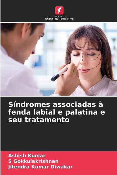 Produktbild: S&iacute;ndromes associadas &agrave; fenda labial e palatina e seu tratamento