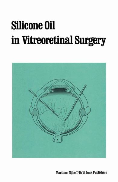Produktbild: Silicone Oil in Vitreoretinal Surgery