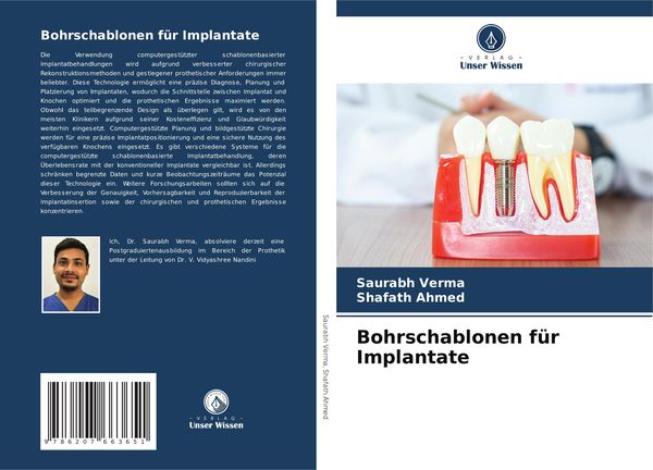 Produktbild: Bohrschablonen f&uuml;r Implantate