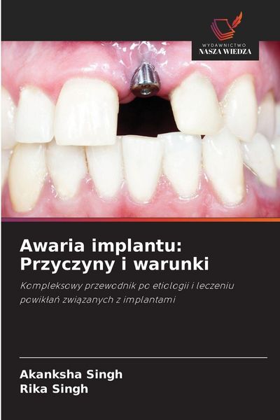Produktbild: Awaria implantu: Przyczyny i warunki