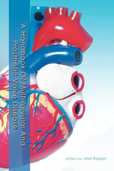 Produktbild: A Handbook Of Multivalvular and Prosthetic Valve Disease