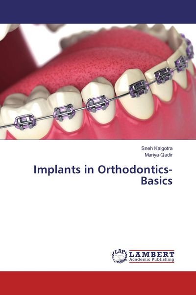 Produktbild: Implants in Orthodontics- Basics