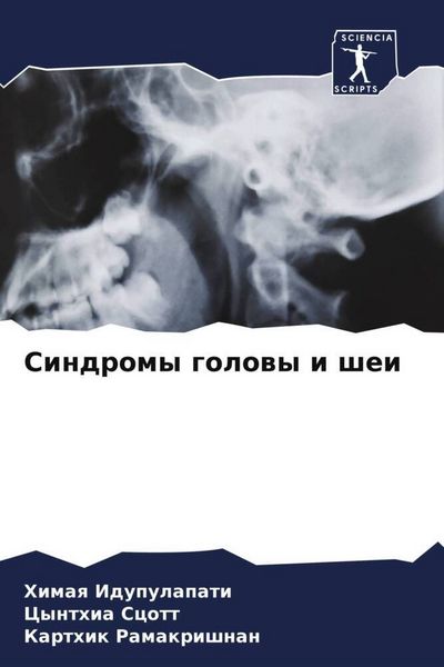 Produktbild: Sindromy golowy i shei