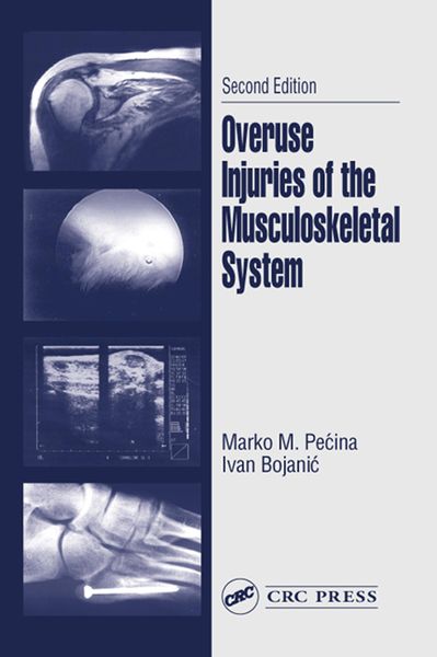 Produktbild: Overuse Injuries of the Musculoskeletal System