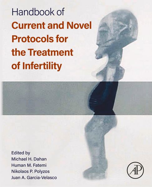 Produktbild: Handbook of Current and Novel Protocols for the Treatment of Infertility