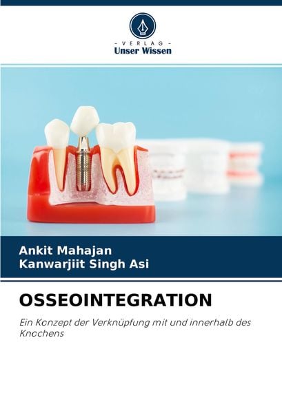 Produktbild: Osseointegration