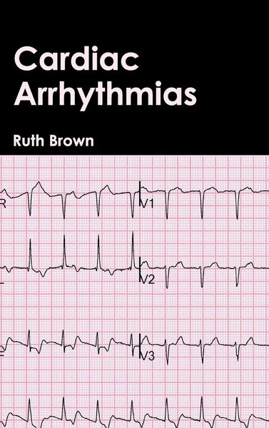 Produktbild: Cardiac Arrhythmias