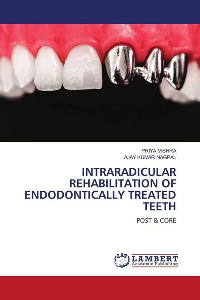 Produktbild: Intraradicular Rehabilitation Of Endodontically Treated Teeth