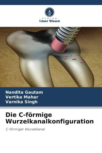 Die C-förmige Wurzelkanalkonfiguration, Taschenbuch von Nandita Gautam , Vertika Mahar , Varnika Singh, Verlag Unser Wissen, 9786205129364