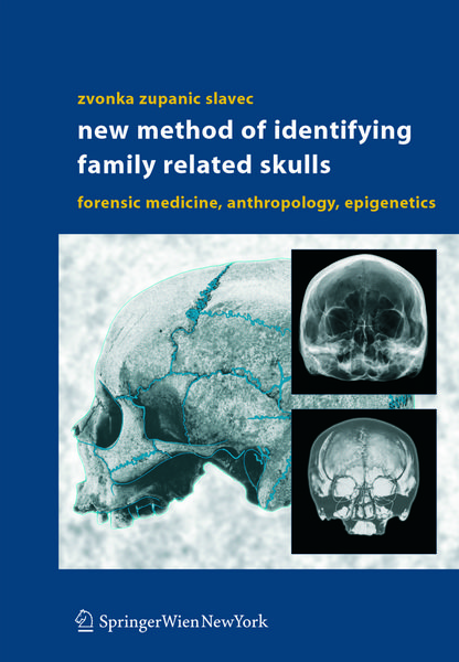 Produktbild: New Method of Identifying Family Related Skulls