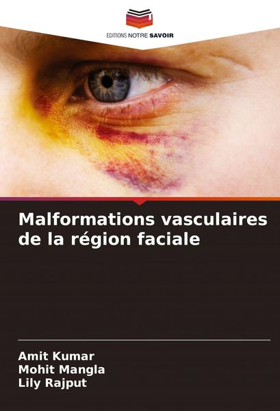 Produktbild: Malformations vasculaires de la r&eacute;gion faciale