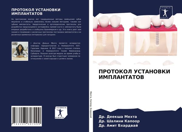 Produktbild: Protokol Ustanovki Implantatov