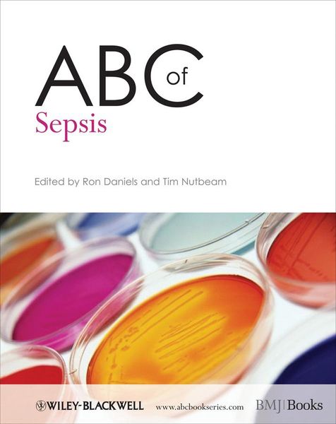 Produktbild: ABC of Sepsis