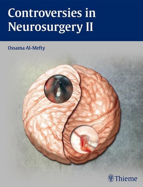 Produktbild: Controversies in Neurosurgery II