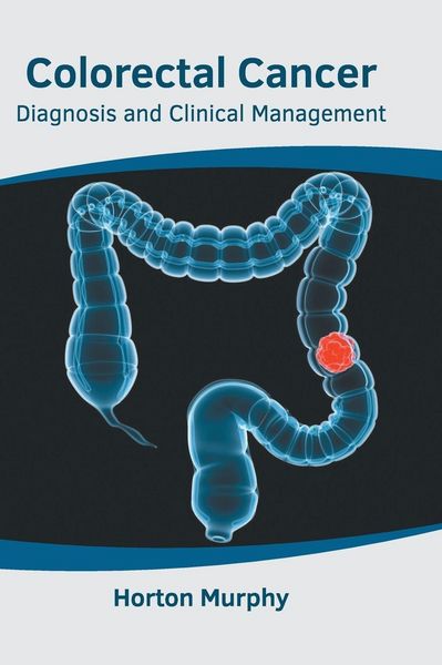 Produktbild: Colorectal Cancer: Diagnosis and Clinical Management