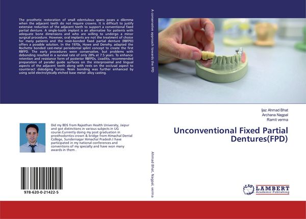 Produktbild: Unconventional Fixed Partial Dentures(FPD)