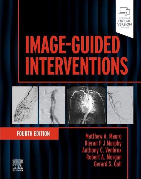 Produktbild: Image-Guided Interventions