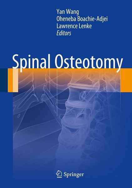 Produktbild: Spinal Osteotomy