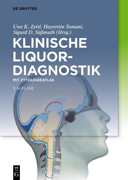 Produktbild: Klinische Liquordiagnostik