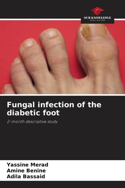 Produktbild: Fungal infection of the diabetic foot
