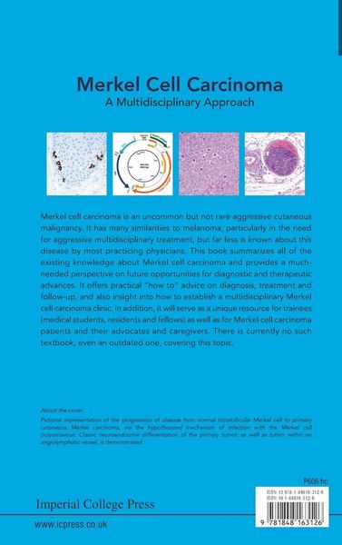 Produktbild: Merkel Cell Carcinoma (v2)