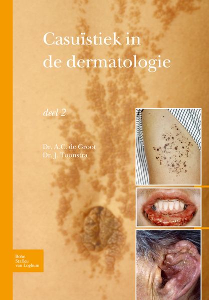 Produktbild: Casu&iuml;stiek in de dermatologie - deel 2