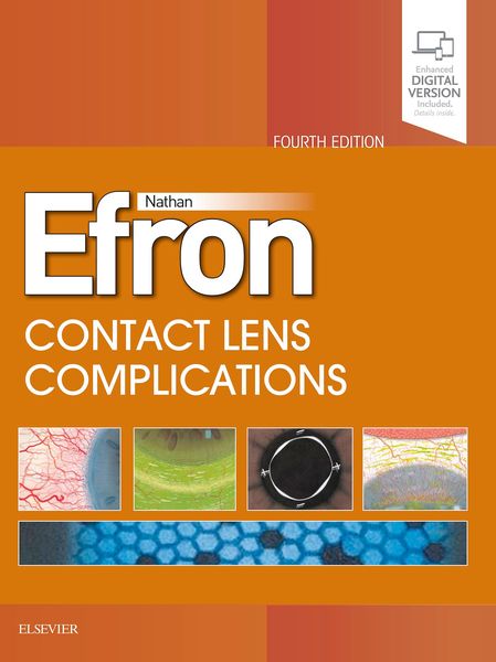 Produktbild: Contact Lens Complications E-Book
