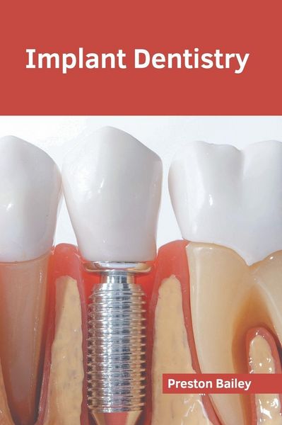 Produktbild: Implant Dentistry
