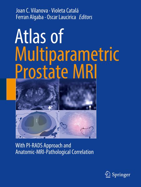 Produktbild: Atlas of Multiparametric Prostate MRI