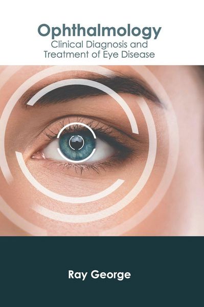 Produktbild: Ophthalmology: Clinical Diagnosis and Treatment of Eye Disease