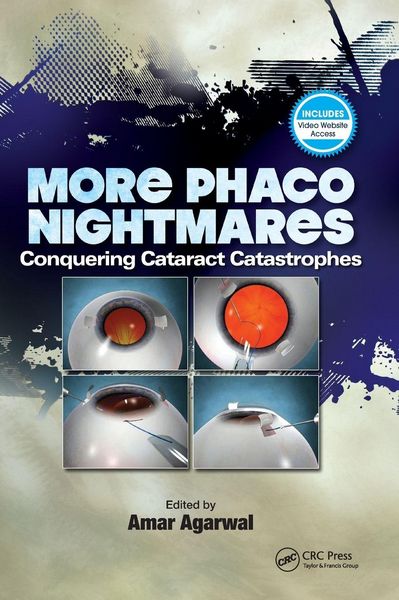 Produktbild: More Phaco Nightmares