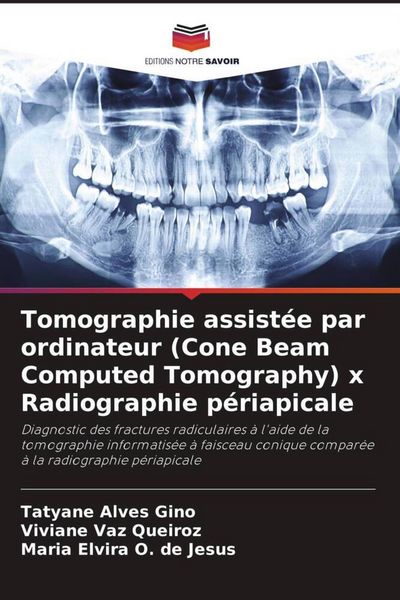 Produktbild: Tomographie assist&eacute;e par ordinateur (Cone Beam Computed Tomography) x Radiographie p&eacute;riapicale