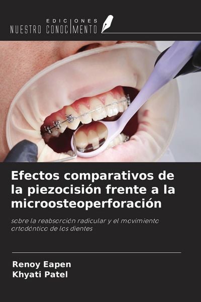 Produktbild: Efectos comparativos de la piezocisi&oacute;n frente a la microosteoperforaci&oacute;n