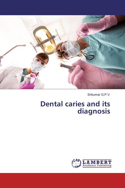 Produktbild: Dental caries and its diagnosis