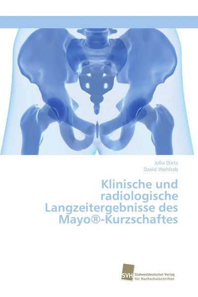Klinische und radiologische Langzeitergebnisse des Mayo -Kurzschaftes, Taschenbuch von Julia Dietz , David Wohlrab, Südwestdeutscher Verlag für