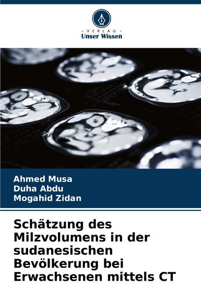 Produktbild: Sch&auml;tzung des Milzvolumens in der sudanesischen Bev&ouml;lkerung bei Erwachsenen mittels CT