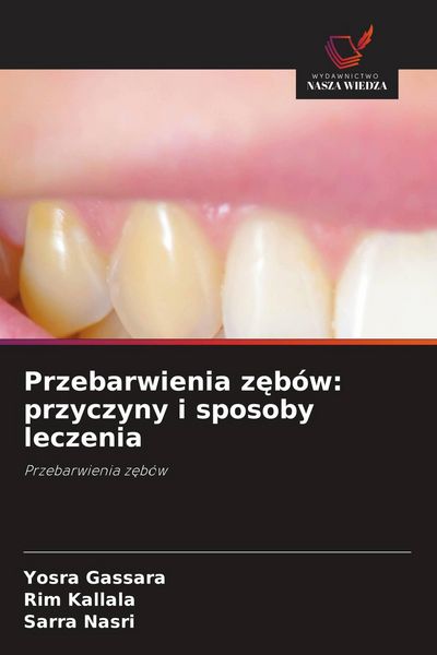 Produktbild: Przebarwienia z&iquest;b&oacute;w: przyczyny i sposoby leczenia
