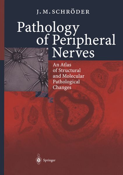 Produktbild: Pathology of Peripheral Nerves