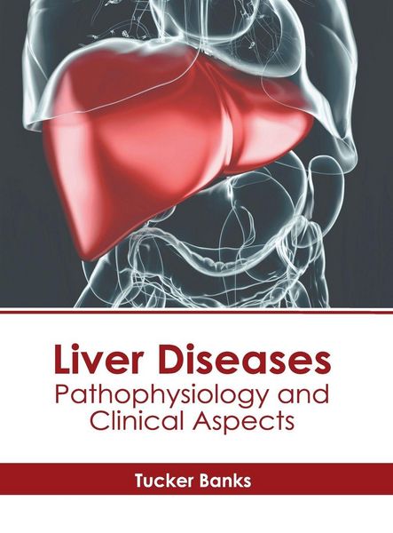 Produktbild: Liver Diseases: Pathophysiology and Clinical Aspects