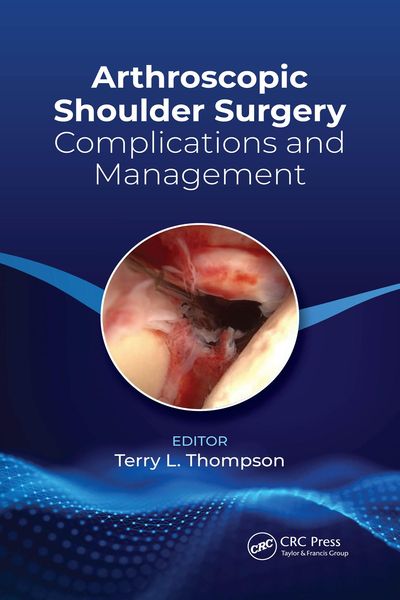 Produktbild: Arthroscopic Shoulder Surgery