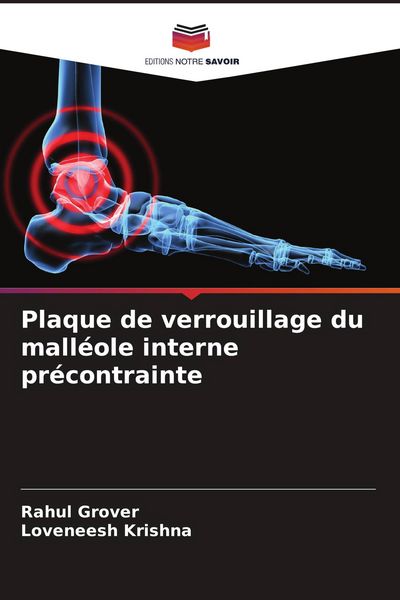 Produktbild: Plaque de verrouillage du mall&eacute;ole interne pr&eacute;contrainte