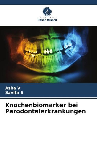 Produktbild: Knochenbiomarker bei Parodontalerkrankungen