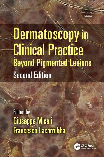 Produktbild: Dermatoscopy in Clinical Practice