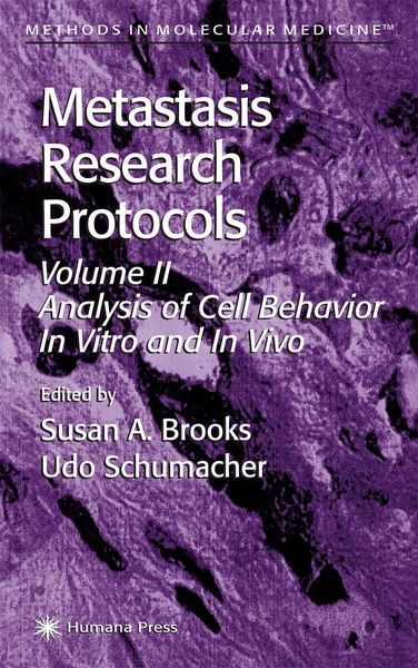 Produktbild: Metastasis Research Protocols
