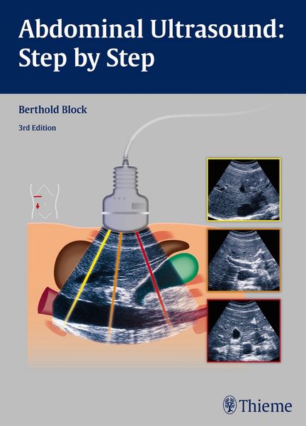 Produktbild: Abdominal Ultrasound: Step by Step